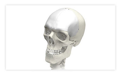 medpor-customized-implants