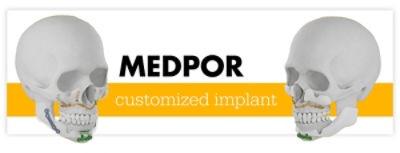 medpor custom cranial implant hero
