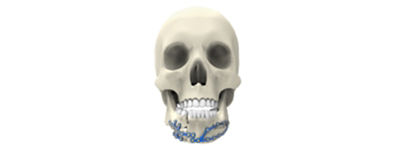 midface-and-mandible-trauma