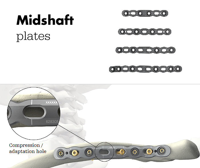 Midshaft Plates