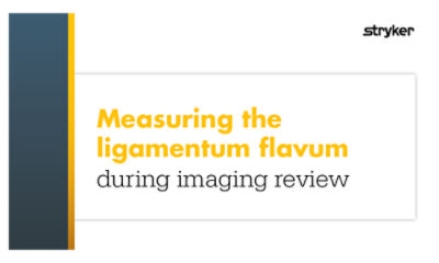 Measuring ligamentum flavum thickness during imaging review to assess candidacy for the mild® procedure