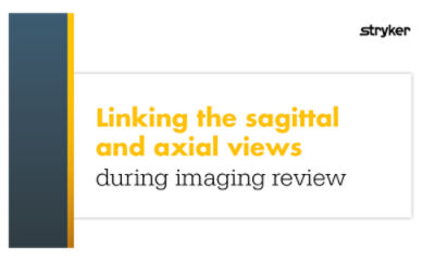 How to link sagittal and axial views during imaging review for mild® patient identification