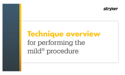 Technique overview for performing the mild® procedure