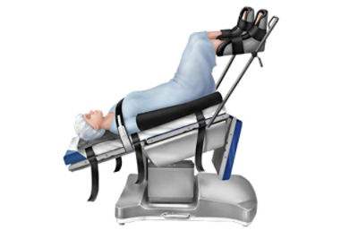 Lithotomy position