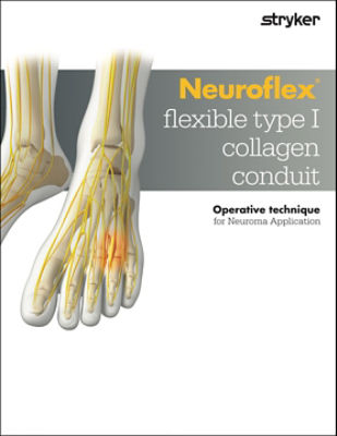 Neuroflex Operative Technique