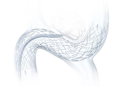 Neuroform Atlas product features image