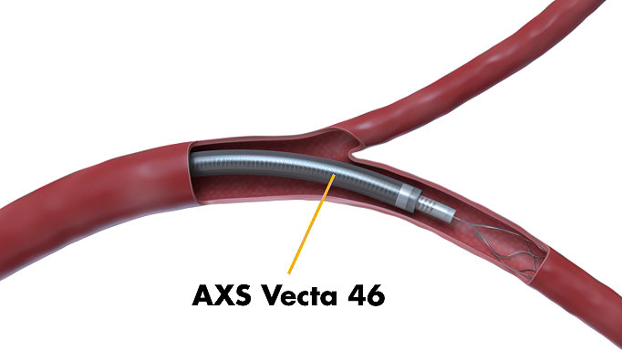 AXS Vecta 46 -- Fit for MeVO