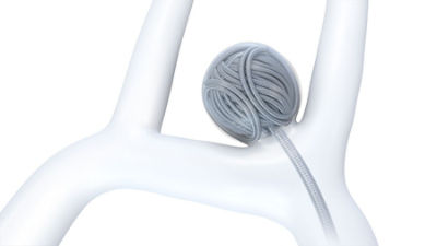 Target Tetra Detachable Coil Stryker