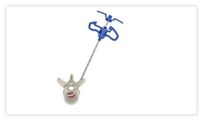 Step 3: Release the lever, then remove the introducer handpiece, leaving the sheath in place