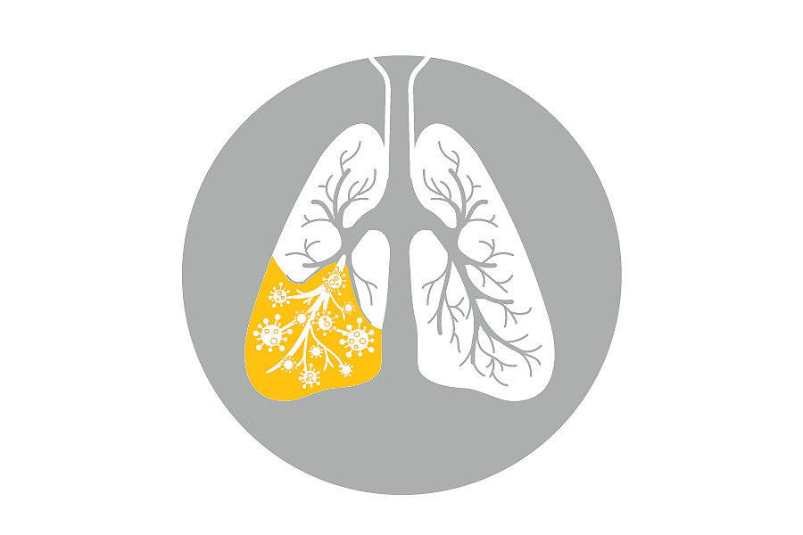 pneumonia-lung-icon