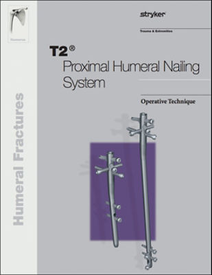 T2 Proximal Humeral operative technique