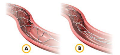 push-deployment-graphic