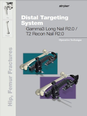 Distal Targeting System R2.0 Gamma3 Long Nail/T2 Recon Nail
