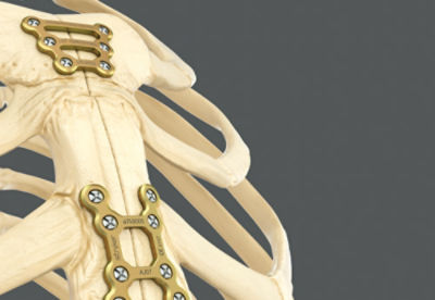 ribcage-hardware-v1