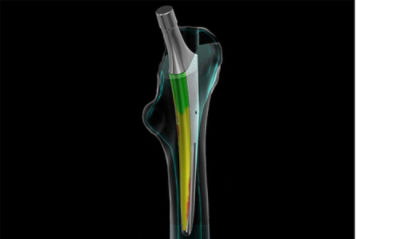 bone-screen-image
