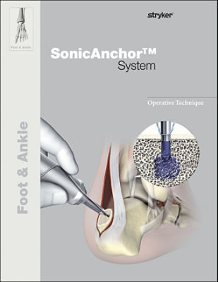 SonicAnchor operative technique