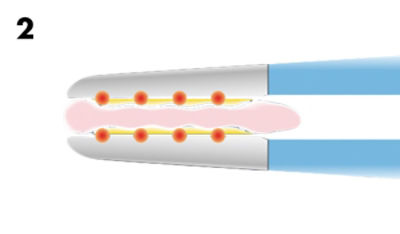 standard-forceps-2