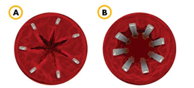 stent-struts-graphic