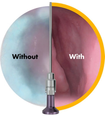 stryker-hydro-with-without