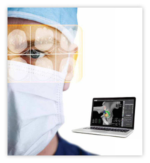 Image of surgeon and Mako Total Hip planning laptop