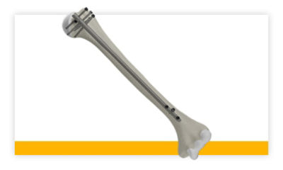 t2-alpha-humerus-thumbnail