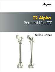 T2 Alpha Femoral Nail GT operative technique