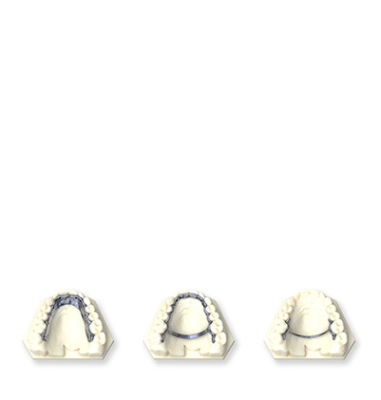 ti-palatal-splints-carousel-mobile