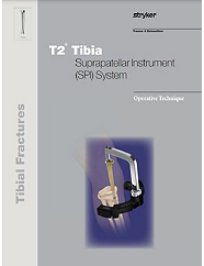 T2 Tibia SPI System Operative Technique