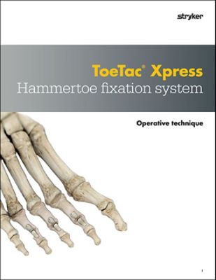 ToeTac Xpress operative technique