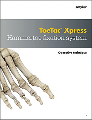 ToeTac Xpress operative technique