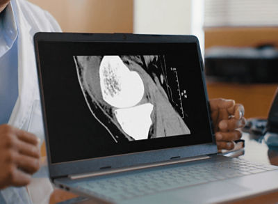 total_knee_scan-