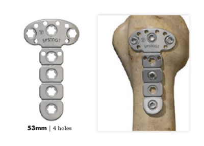 Greater Tuberosity Plate