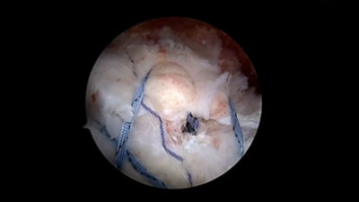 ssr-tech-verma-thumb