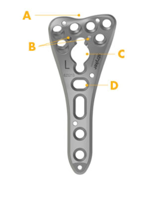 Volar Distal Radius plate