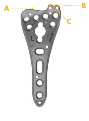 Extended Volar Distal Radius plate