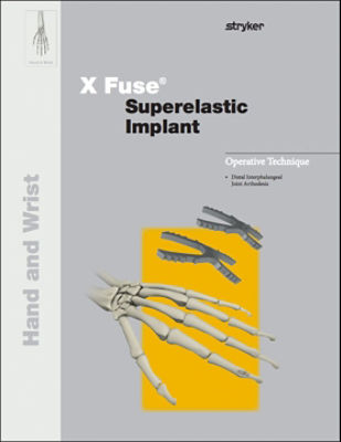 X-Fuse operative technique